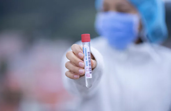 Teste serológico na pesquisa de anticorpos contra o SARS-CoV-2: será sinónimo de imunidade ou não? - Sapo Lifestyle