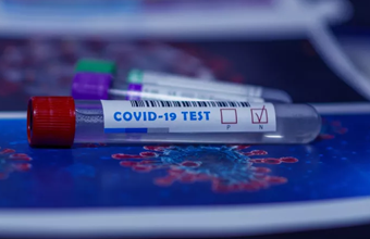 COVID-19: Teste serológico rápido ou laboratorial? O que escolher? - Sapo lifestyle